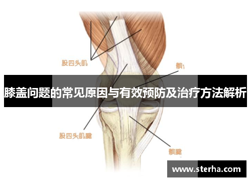 膝盖问题的常见原因与有效预防及治疗方法解析 膝盖问题的常见原因与有效预防及治疗方法解析